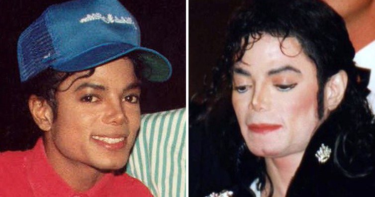 迈克尔杰克逊为什么变白（为什么迈克尔.杰克逊生前皮肤变得越来越白？）