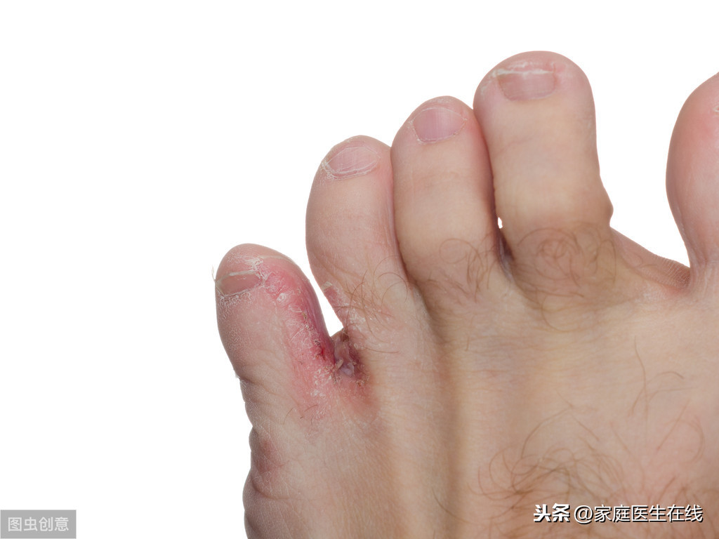 脚臭的原因（4个原因，会让你的脚“发臭”，麻烦远离它们）
