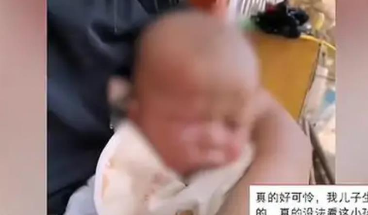 妇联回应5个月婴儿被打肿脸（疑似被精神病妈妈殴打）