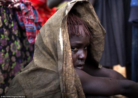 非洲女孩的割礼是什么（非洲少女割礼现场曝光 惨不忍睹只为免除其性快感）